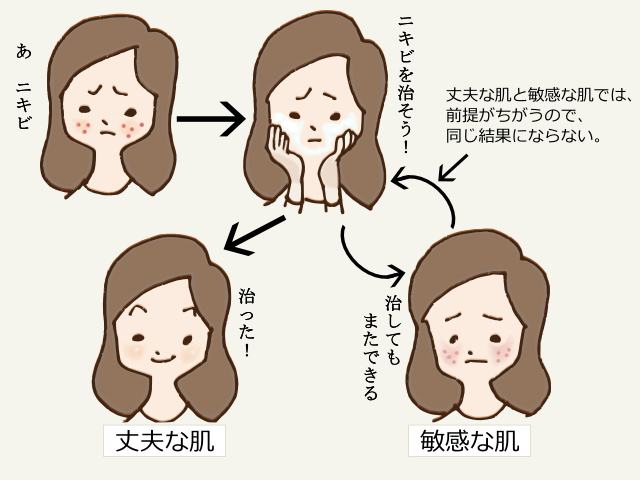 肌質によってニキビ治療の効果は変わる