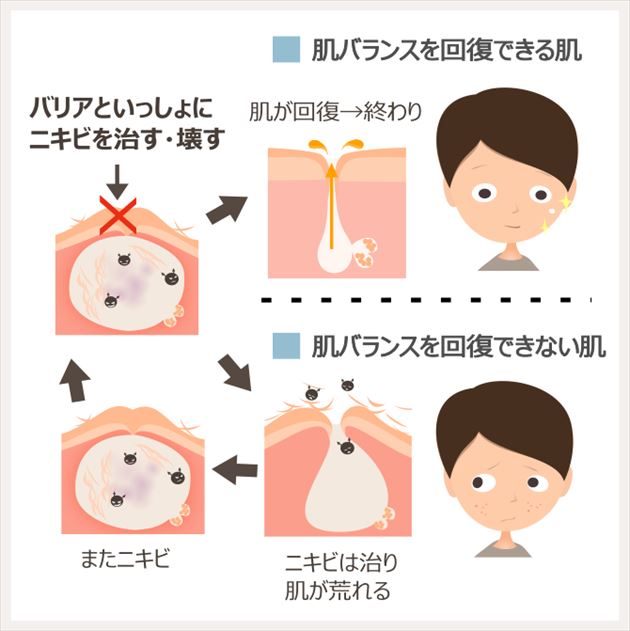 ニキビが治らない状態は、ニキビが出続ける肌の状態