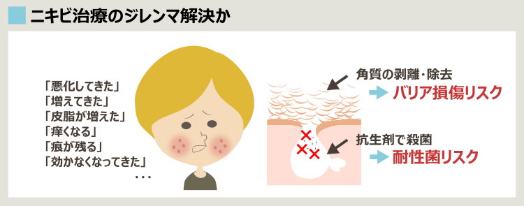 今までのニキビ治療のデメリットやリスクを回避