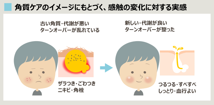 角質ケアの宣伝に多いニキビ改善のイメージ
