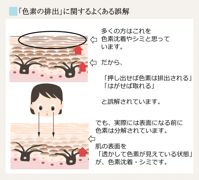 ニキビ跡の色素沈着は、色素産生のくり返し