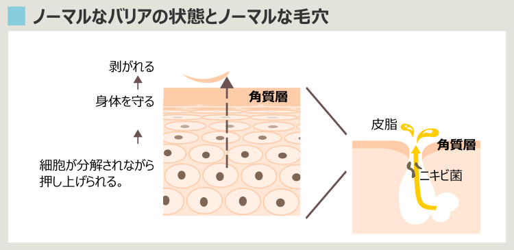 ノーマルな肌・ノーマルな毛穴（ニキビに悩まない肌の状態）