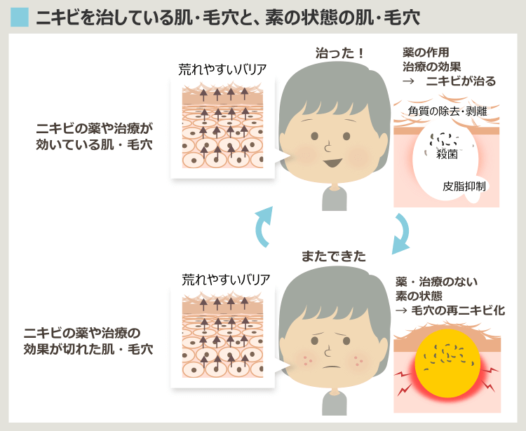 治療が効いている肌・毛穴と、本来の素の状態の肌・毛穴