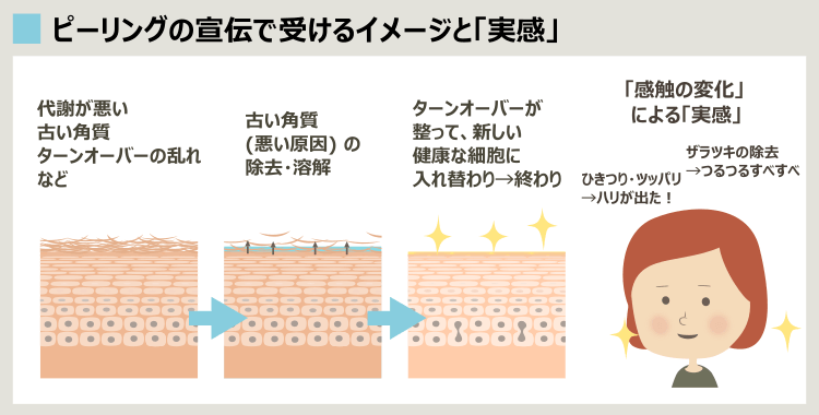 ピーリングの宣伝でよくある古い角質・ターンオーバーの乱れという誤解