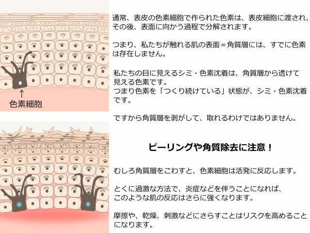 ピーリングで色素が増え、ニキビ跡の悪化