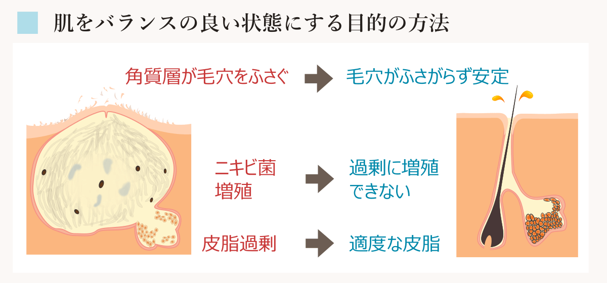 ニキビができなくなる方針