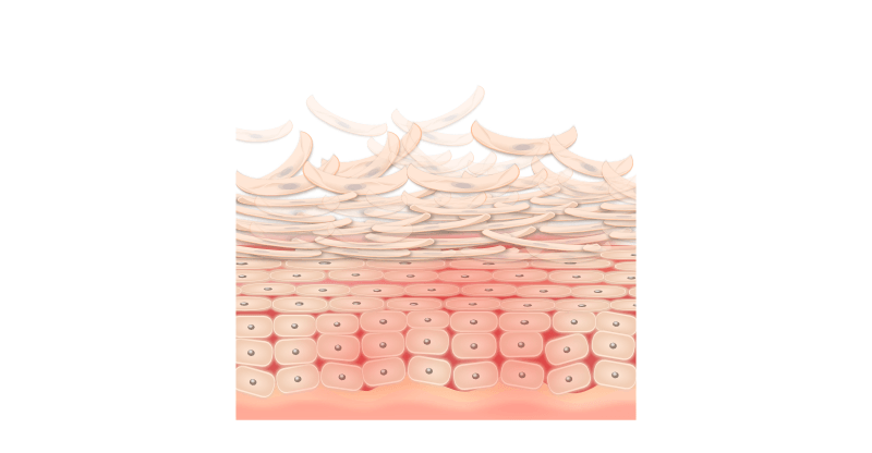 レチノイン酸による角質の剥離