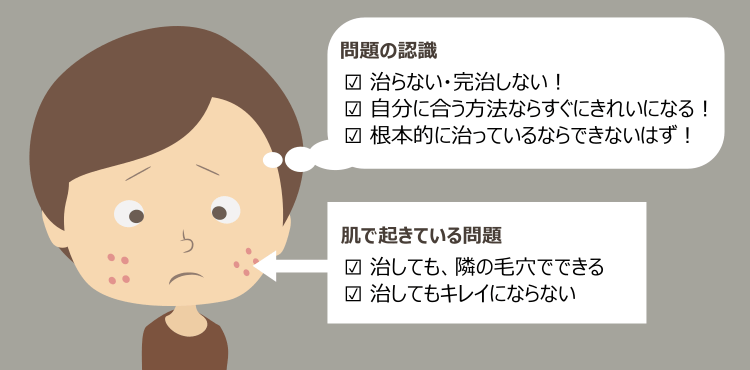 アグネス治療や脂腺凝固法が効かないと感じる誤解