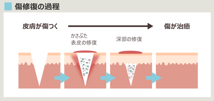 傷修復のプロセス