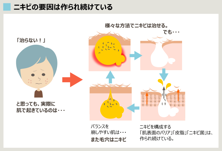 ティーツリーでもニキビが治らない根本原因