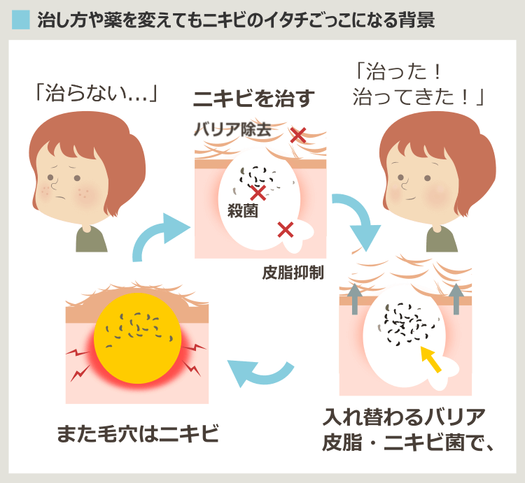 ニキビのイタチごっこ-治療が効いても完治しても、ニキビをくり返す原理