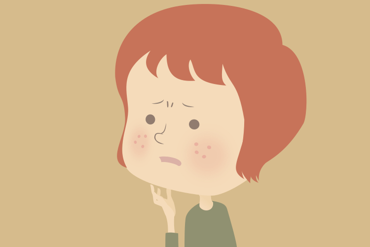 ニキビと治療のイタチごっこ。どうすれば？