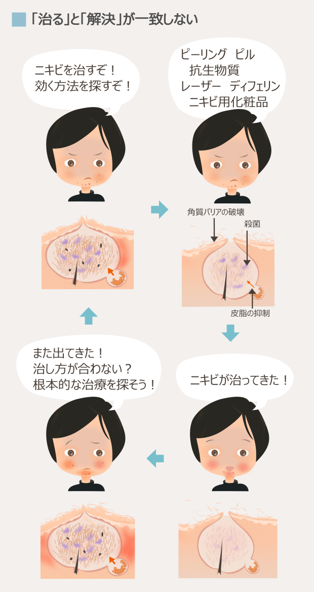 顎ニキビの原因と くり返す顎ニキビの解決方法