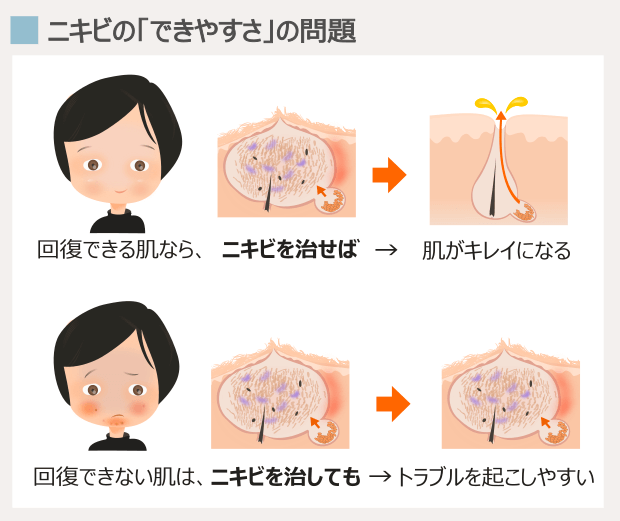 顎ニキビの「解決」に必要な条件