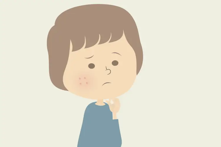 治療後にニキビが再発やすい人の生活習慣・心理とは？