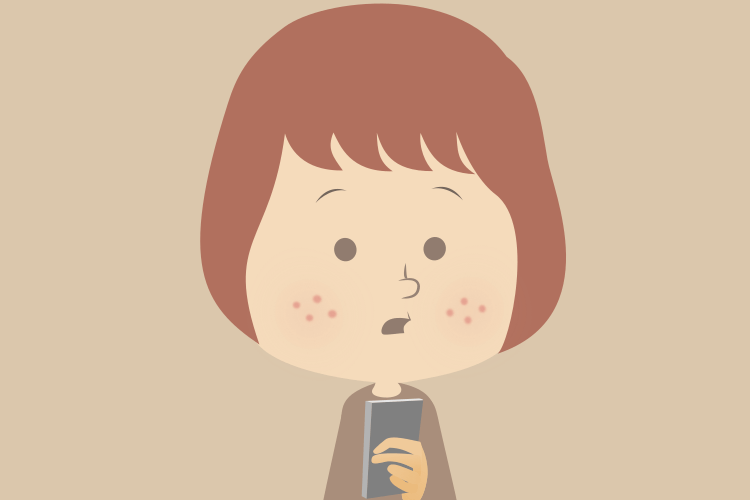皮膚科医が解説「ニキビに関する5つの神話」
