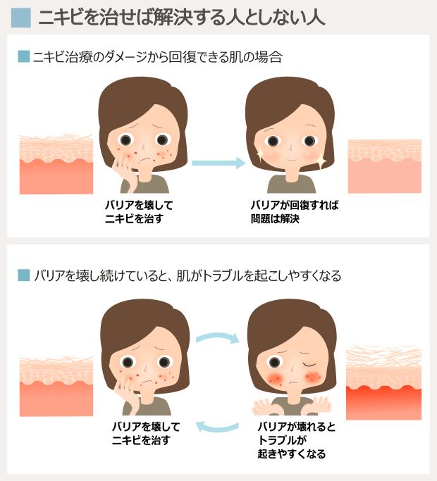 角質層が回復できないと、悪化や再発