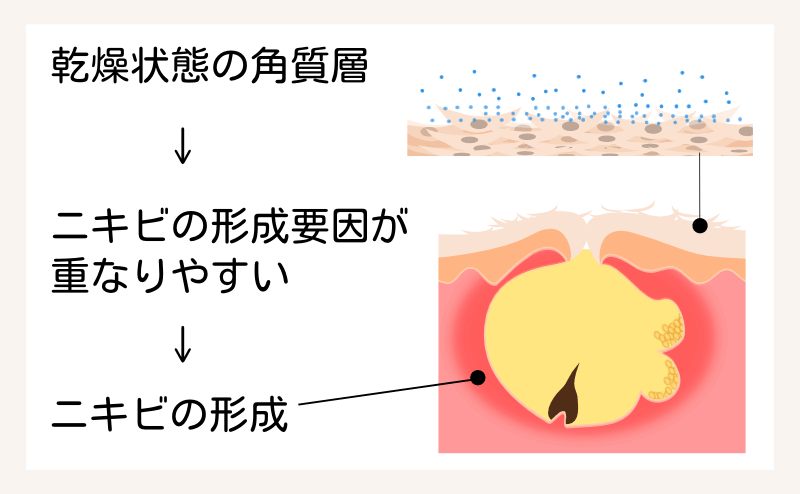 乾燥した角質層とニキビ