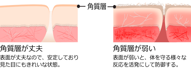 epidermis-defense-reaction