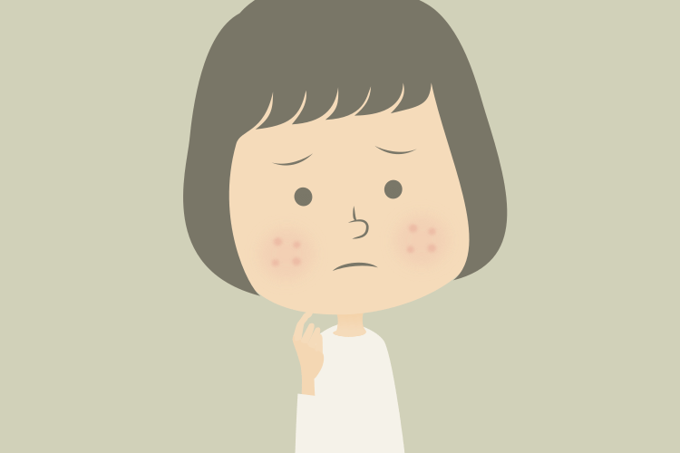 にきびケアのリスク