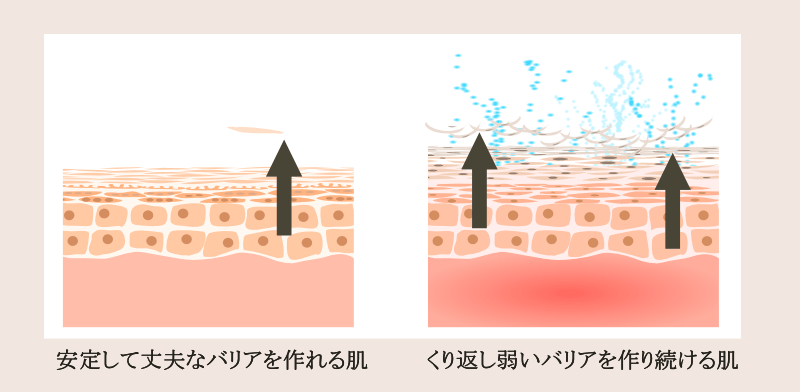 普通の肌とニキビが慢性化する肌