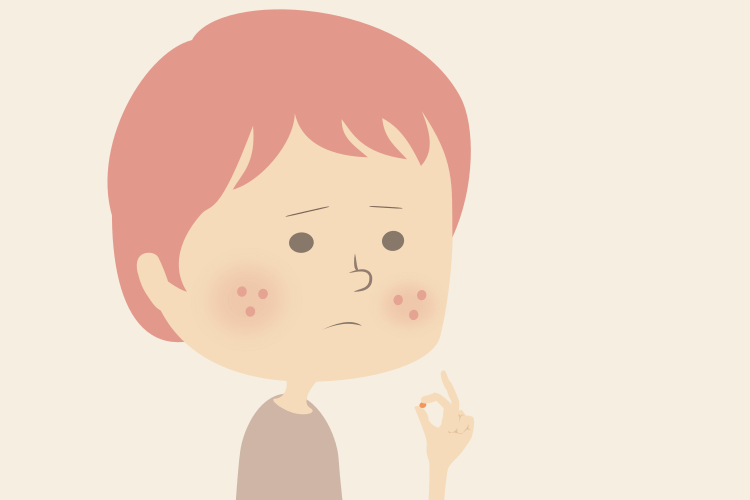 薬に頼らずニキビを治したい-