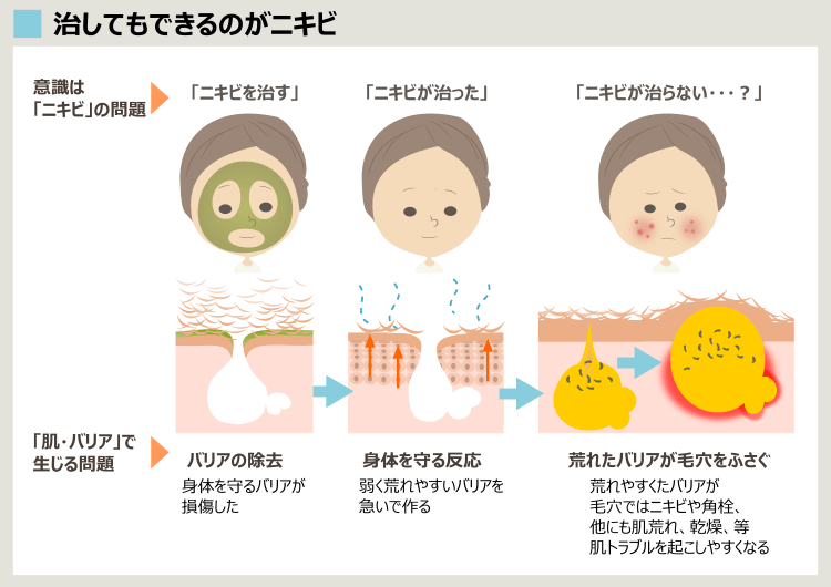 ハーブピーリングでもニキビが治らない場合の理由