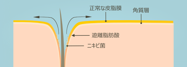 正常な皮膚の皮脂膜