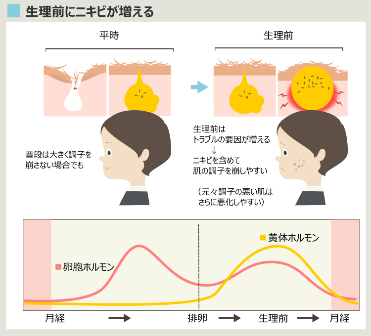 ニキビと生理周期による女性ホルモンの変化の関係