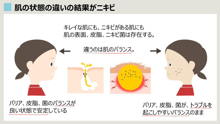 治らないニキビの解決方法