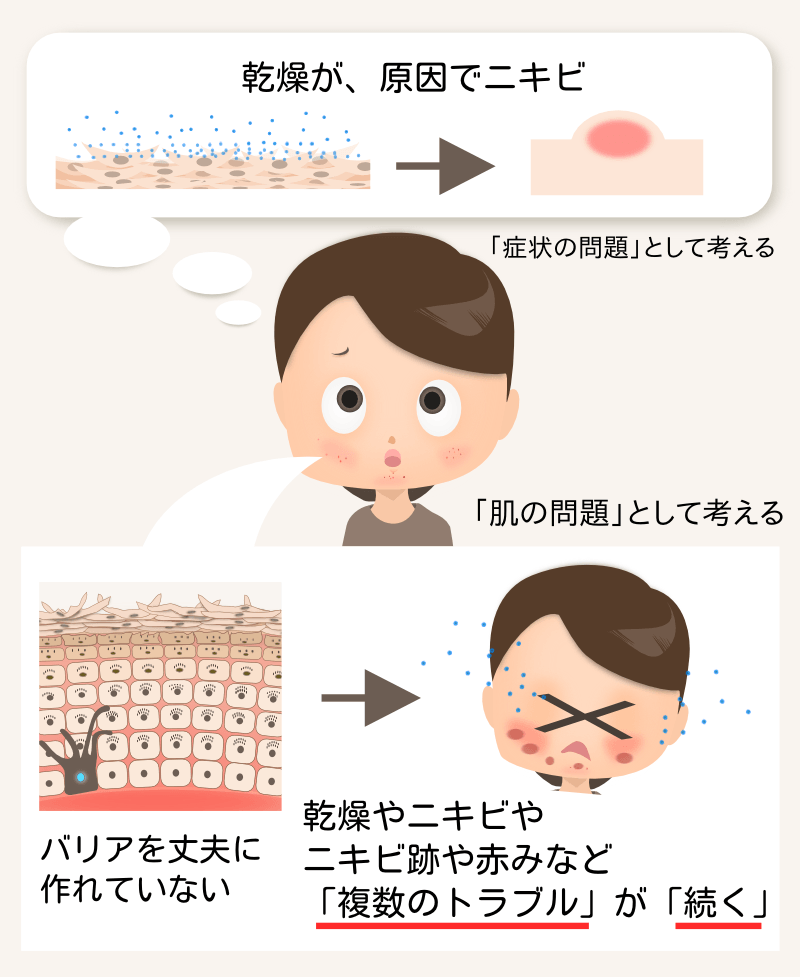 乾燥もニキビもトラブルを起こしやすい肌の症状の一つ