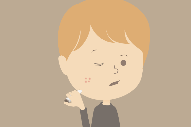 ニキビの自宅注射治療研究