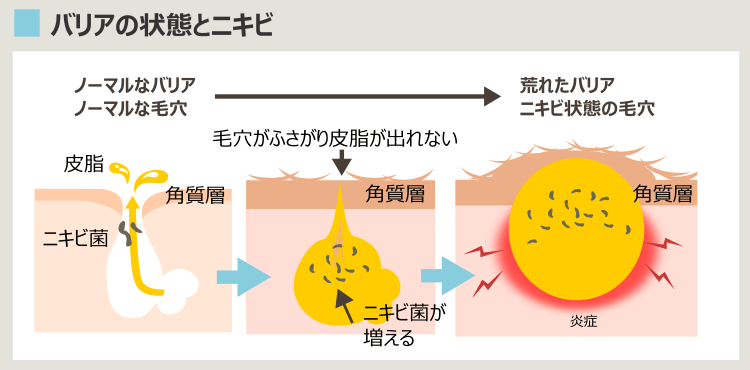 肌の機能とニキビ