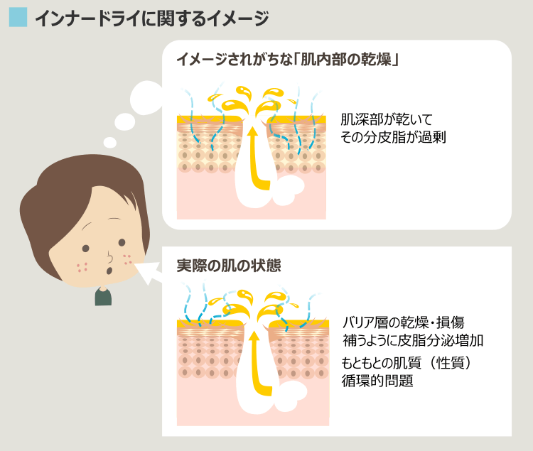 インナードライのイメージと実際