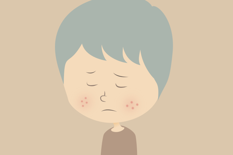 イソトレチノインをめぐる裁判