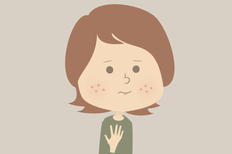 ニキビへのイソトレチノインはプロラクチン値上昇と関連