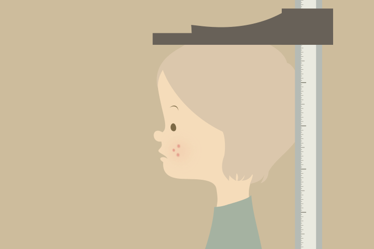 イソトレチノインの思春期の成長への関与