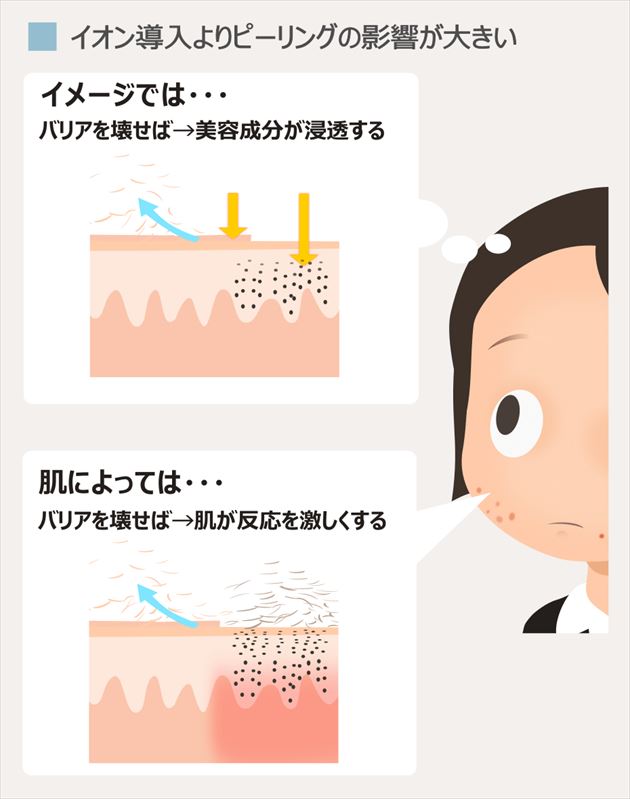 フェイスラインニキビとイオン導入とピーリング