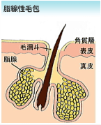 ニキビができやすい毛穴・脂腺