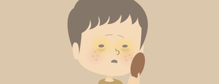 肝臓疾患と黄疸