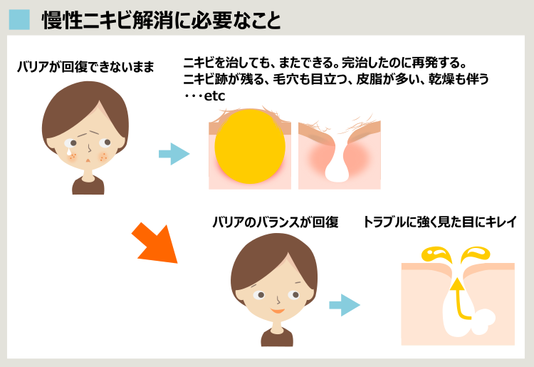 リンパマッサージでニキビ悪化 なぜ