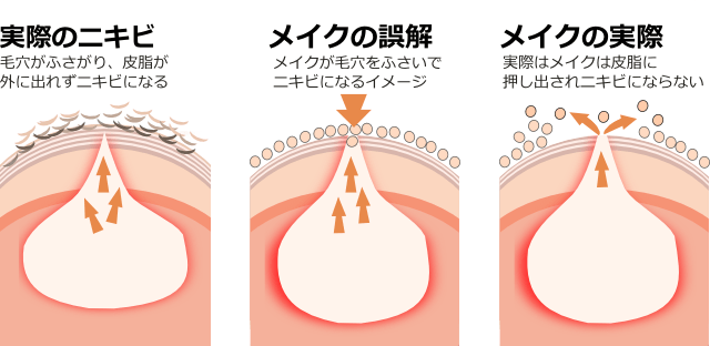 ベースメイクでニキビにはならない