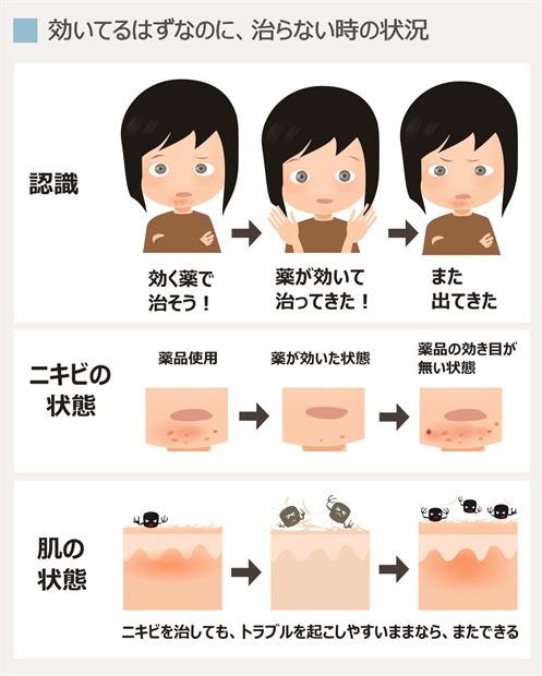 顎ニキビに効く薬と 効いてもくり返すニキビの解決方法