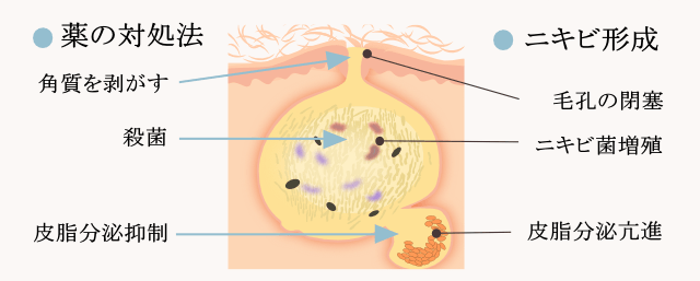 medicine-acne-cure