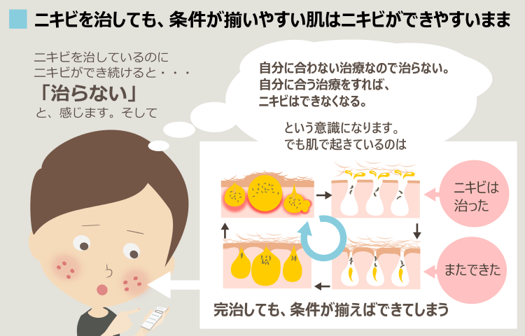 保険適用外治療でもニキビが治らないと感じる心理状態と、肌の状態