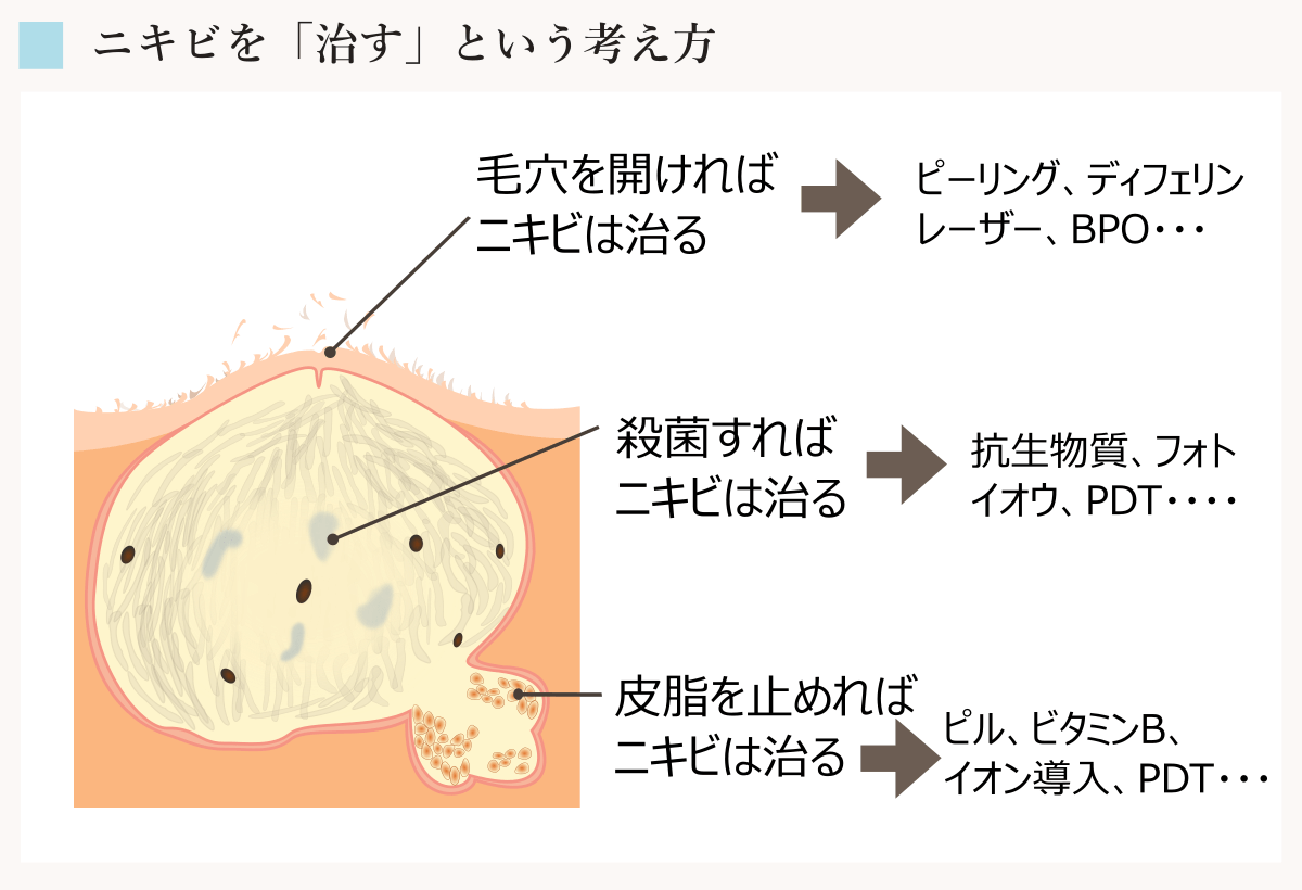 効果を期待したpdtのニキビ治療 でも再発した という方に