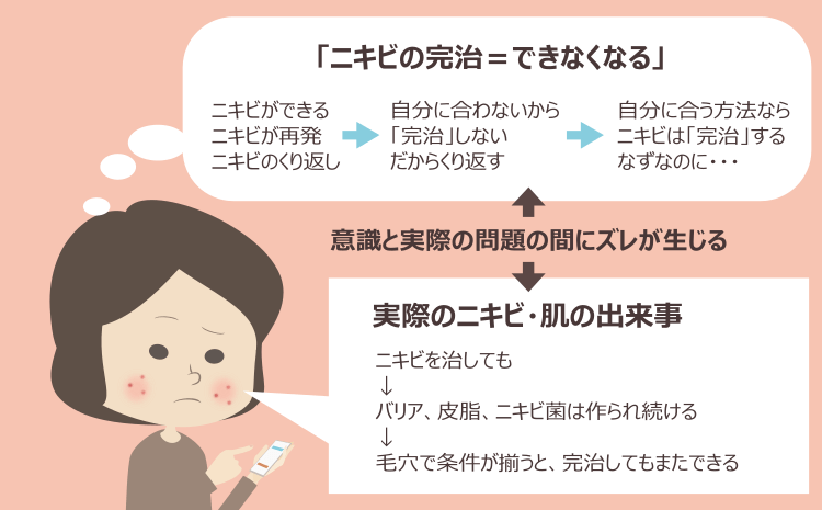 自分に合うニキビ治療ならニキビは出来なくなるという誤解