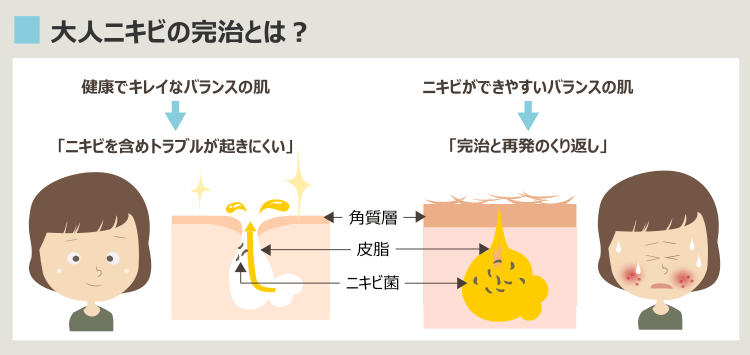 大人ニキビの慢性化