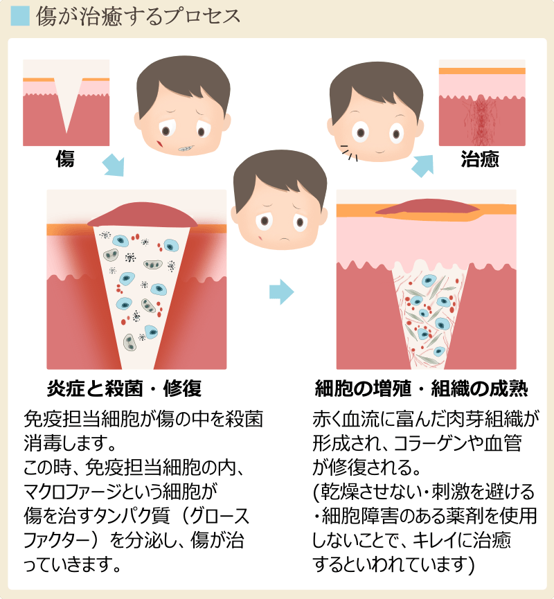 傷の治癒とニキビ跡が残らないプロセス