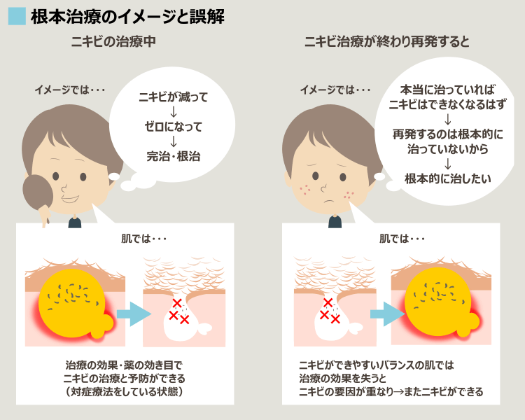 ニキビ治療は対症療法の連続